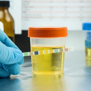 How Long Does Thca Stay In Your System