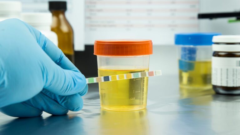 How Long Does Thca Stay In Your System